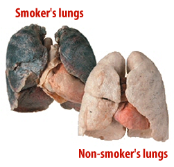 lung-comparison.png